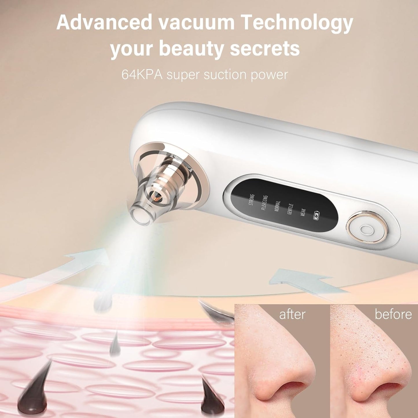 Blackhead Remover Pore Vacuum Kit for Face, 5 Adjustable Suction Levels Blackhead Extraction Tool, Face Suction Pore Cleaner with 4 Suction Heads, 4 Probes for Women & Men（White